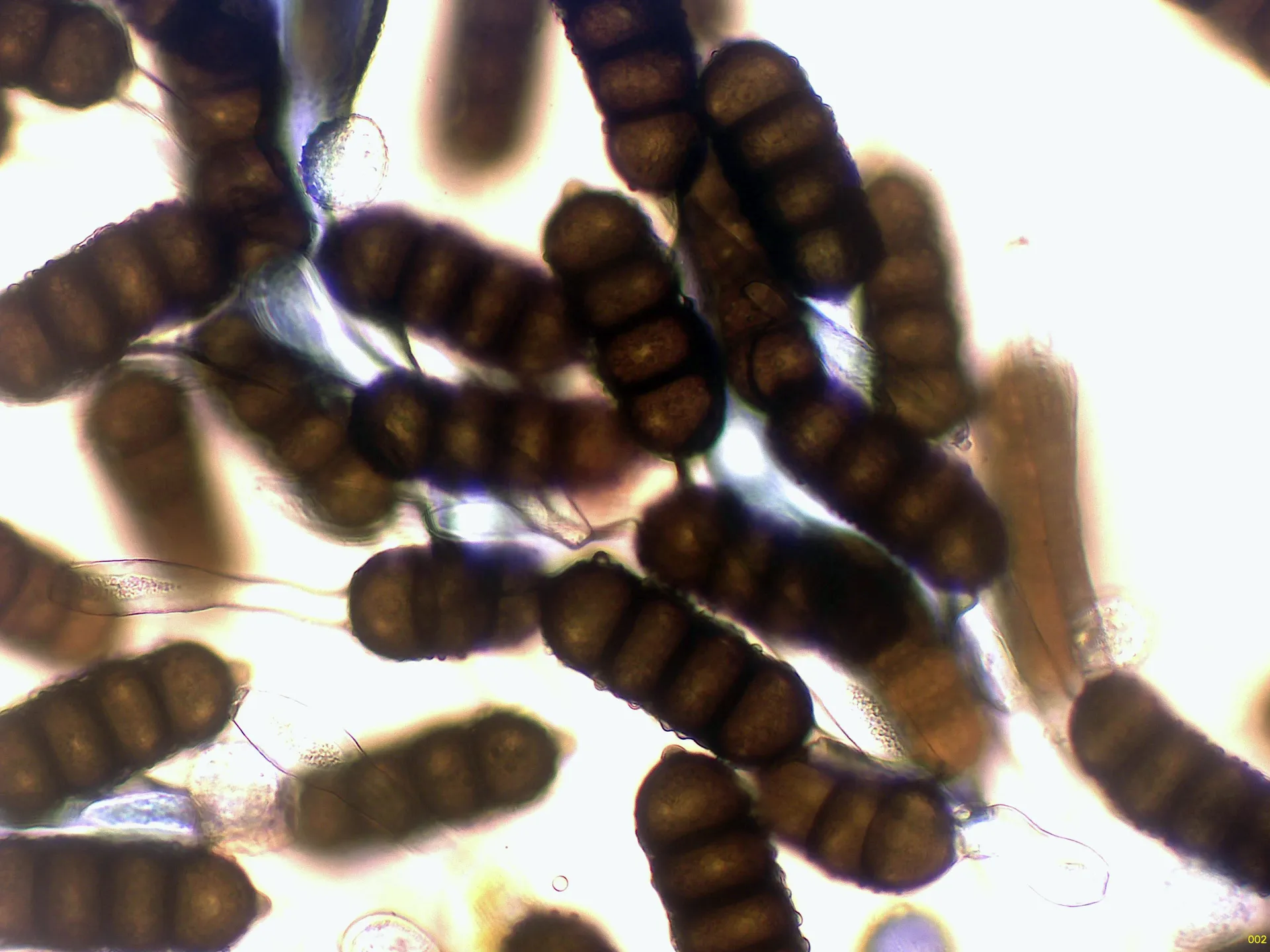 Microscopía de Phragmidium violaceum - 10 - Teliosporas x 400-002
